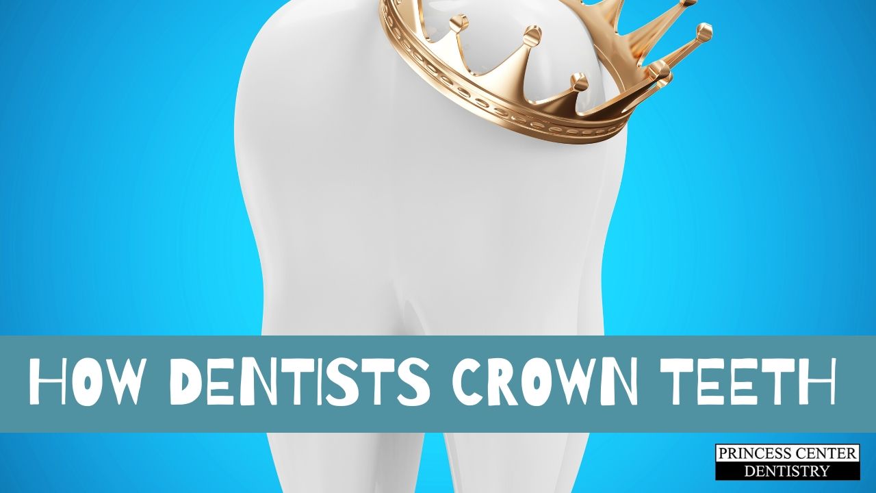 A tooth wearing a crown