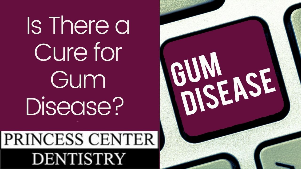 Donna of Princess Center Dentistry in Scottsdale AZ, answers the question: Is there a cure for gum disease?