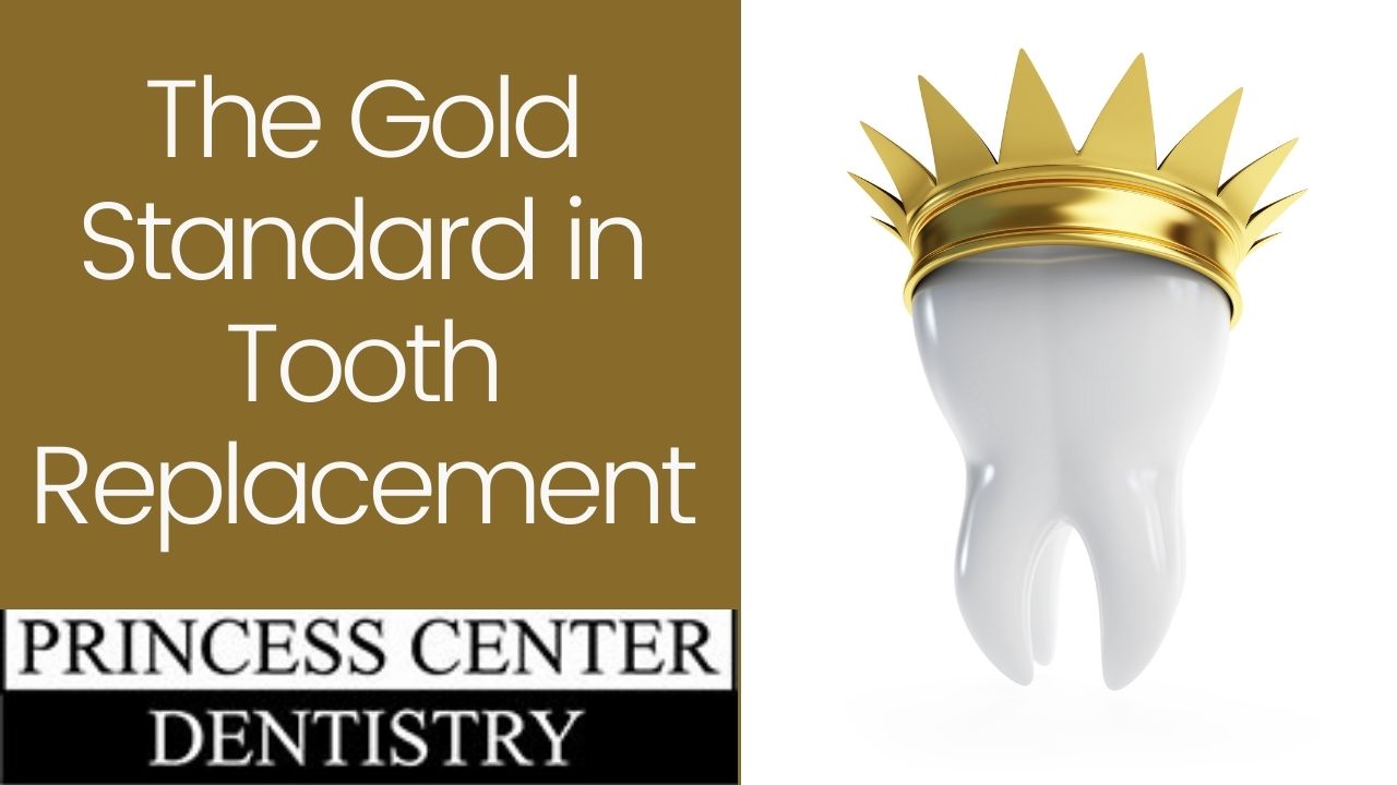Oh no! Do you need a tooth replaced? Wondering, what can you do? Wonder no more. Dr. Katelyn Fenlon of Princess Center Dentistry in Scottsdale, Arizona answers the question: What’s the gold standard in tooth replacement?