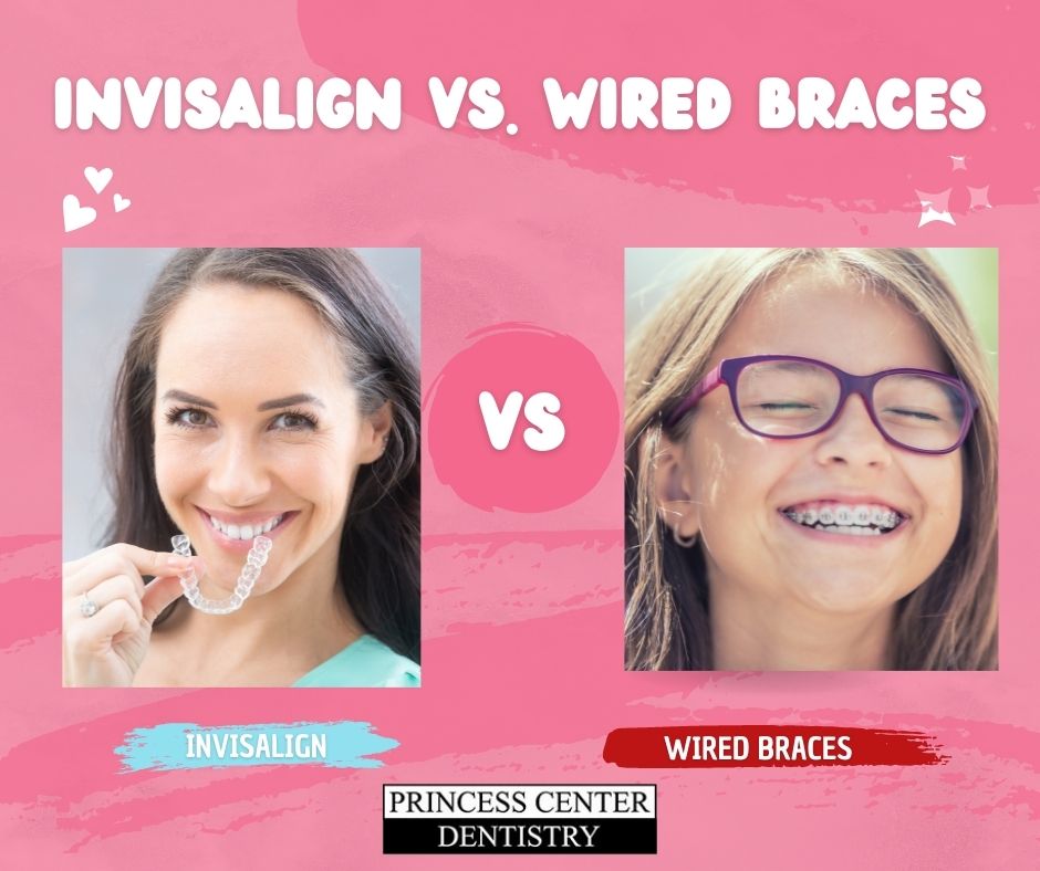 Is Invisalign less painful than metal braces? Does Invisalign hurt? A look into the side effects of Invisalign, including covering whether or not there is any pain. Dr. Lewandowski of Princess Center Dentistry in Scottsdale, Arizona answers these questions about Invisalign and more.
